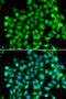 SUFU Negative Regulator Of Hedgehog Signaling antibody, 14-985, ProSci, Immunofluorescence image 