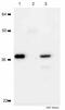 NFKB Inhibitor Alpha antibody, ab32518, Abcam, Immunoprecipitation image 