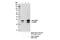 Catechol-O-Methyltransferase antibody, 14368S, Cell Signaling Technology, Immunoprecipitation image 