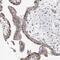 RWD Domain Containing 2A antibody, NBP1-85167, Novus Biologicals, Immunohistochemistry frozen image 