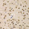 Cyclin Dependent Kinase 7 antibody, LS-C331642, Lifespan Biosciences, Immunohistochemistry frozen image 