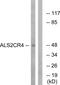 Transmembrane Protein 237 antibody, GTX87300, GeneTex, Western Blot image 