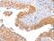 Adaptor Related Protein Complex 1 Subunit Beta 1 antibody, LS-C402888, Lifespan Biosciences, Immunohistochemistry paraffin image 