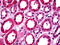 T-Box 18 antibody, 25-398, ProSci, Immunohistochemistry paraffin image 