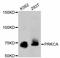 Protein Kinase C Alpha antibody, abx125382, Abbexa, Western Blot image 