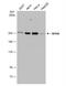 Myosin Heavy Chain 9 antibody, NBP1-31733, Novus Biologicals, Western Blot image 