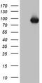 Tousled Like Kinase 2 antibody, TA805462S, Origene, Western Blot image 