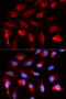 Peroxisome Proliferator Activated Receptor Delta antibody, STJ27623, St John