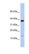 Ribosomal Protein L27 antibody, NBP1-54629, Novus Biologicals, Western Blot image 