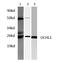 Ubiquitin C-Terminal Hydrolase L1 antibody, LS-C175837, Lifespan Biosciences, Western Blot image 