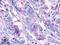 Adhesion G Protein-Coupled Receptor A2 antibody, LS-A2167, Lifespan Biosciences, Immunohistochemistry paraffin image 