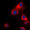 Glycerol Kinase antibody, orb213981, Biorbyt, Immunofluorescence image 