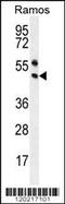 Paired Box 5 antibody, MBS9205685, MyBioSource, Western Blot image 