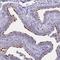 Transmembrane Protein 138 antibody, NBP1-92528, Novus Biologicals, Immunohistochemistry frozen image 