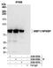WW Domain Binding Protein 11 antibody, A304-856A, Bethyl Labs, Immunoprecipitation image 