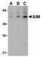 CD5 Molecule Like antibody, AP05216PU-N, Origene, Western Blot image 