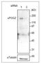 Pogo Transposable Element Derived With ZNF Domain antibody, GTX00892, GeneTex, Western Blot image 