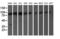 Proteasome 26S Subunit, Non-ATPase 2 antibody, LS-C173166, Lifespan Biosciences, Western Blot image 