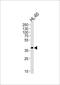 Haptoglobin-related protein antibody, PA5-48124, Invitrogen Antibodies, Western Blot image 