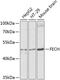 Ferrochelatase antibody, GTX65973, GeneTex, Western Blot image 