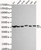 Glutamic-Oxaloacetic Transaminase 2 antibody, STJ99292, St John