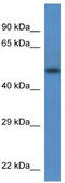 Transcobalamin 2 antibody, TA346535, Origene, Western Blot image 