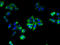 Transmembrane And Tetratricopeptide Repeat Containing 1 antibody, A66014-100, Epigentek, Immunofluorescence image 