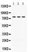 P21 (RAC1) Activated Kinase 5 antibody, PB9733, Boster Biological Technology, Western Blot image 