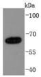 NUMB Endocytic Adaptor Protein antibody, A01206-1, Boster Biological Technology, Western Blot image 