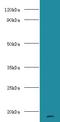 Major urinary proteins 11 and 8 antibody, LS-C369059, Lifespan Biosciences, Western Blot image 