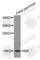 Insulin antibody, A2090, ABclonal Technology, Western Blot image 