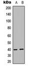 PRAS40 antibody, LS-C358412, Lifespan Biosciences, Western Blot image 