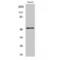 Activating Transcription Factor 2 antibody, LS-C382207, Lifespan Biosciences, Western Blot image 