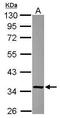 Fructosamine 3 Kinase Related Protein antibody, PA5-30819, Invitrogen Antibodies, Western Blot image 