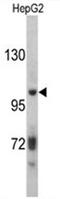 Inter-Alpha-Trypsin Inhibitor Heavy Chain 2 antibody, AP17511PU-N, Origene, Western Blot image 