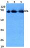 Lipase E, Hormone Sensitive Type antibody, GTX33956, GeneTex, Western Blot image 