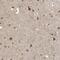 Ribonuclease P/MRP Subunit P40 antibody, NBP1-88765, Novus Biologicals, Immunohistochemistry paraffin image 