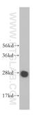 Mediator Complex Subunit 20 antibody, 17598-1-AP, Proteintech Group, Western Blot image 