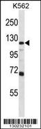 Glutamate Ionotropic Receptor AMPA Type Subunit 4 antibody, MBS9208155, MyBioSource, Western Blot image 