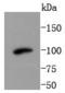 Phosphatidylinositol 3-Kinase Catalytic Subunit Type 3 antibody, A02356-1, Boster Biological Technology, Western Blot image 