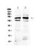 Formin 1 antibody, PA5-79275, Invitrogen Antibodies, Western Blot image 
