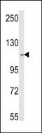 Mtr4 Exosome RNA Helicase antibody, PA5-49633, Invitrogen Antibodies, Western Blot image 