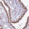 Mitochondrial Ribosomal Protein L54 antibody, NBP2-48761, Novus Biologicals, Immunohistochemistry paraffin image 