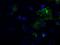 L1 Cell Adhesion Molecule antibody, GTX84244, GeneTex, Immunocytochemistry image 