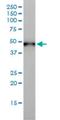 Keratin-17 antibody, H00003872-M01, Novus Biologicals, Western Blot image 