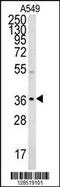 Neugrin, Neurite Outgrowth Associated antibody, MBS9202469, MyBioSource, Western Blot image 