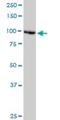 DEAD/H-Box Helicase 11 antibody, H00001663-M03, Novus Biologicals, Western Blot image 