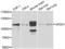 Adaptor Related Protein Complex 2 Subunit Alpha 1 antibody, AHP2432, Bio-Rad (formerly AbD Serotec) , Western Blot image 