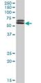 TATA-Box Binding Protein Associated Factor 6 antibody, H00006878-D01P, Novus Biologicals, Western Blot image 