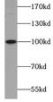 ATPase Na+/K+ Transporting Subunit Alpha 2 antibody, FNab00694, FineTest, Western Blot image 